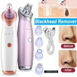 Vacuum Electric Facial Pore Blackhead Remover Acne Cleaner Suction Dermabrasion